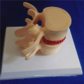 Esqueleto Humano Vertebra Columna Demostración Médica Biología Modelo